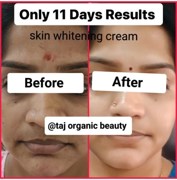 ADVANCE SKIN WHITENING CREAM - Image 3