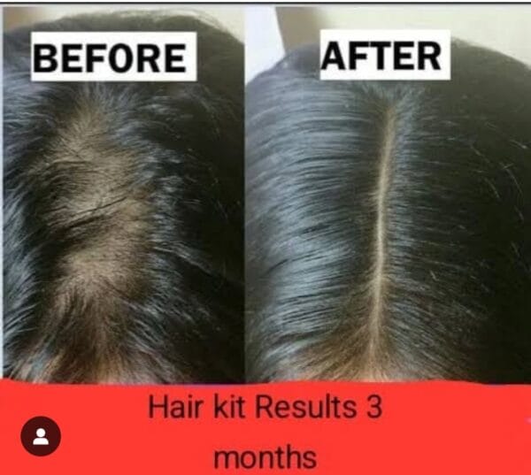 HAIR REGROWTH TONER - Image 2